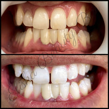 Load image into Gallery viewer, Organic Teeth Whitening