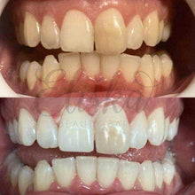 Load image into Gallery viewer, Organic Teeth Whitening