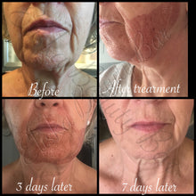 Load image into Gallery viewer, Skin Treatments