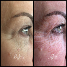 Load image into Gallery viewer, Skin Treatments