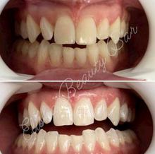 Load image into Gallery viewer, Organic Teeth Whitening