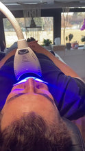 Load and play video in Gallery viewer, Teeth Whitening Service
